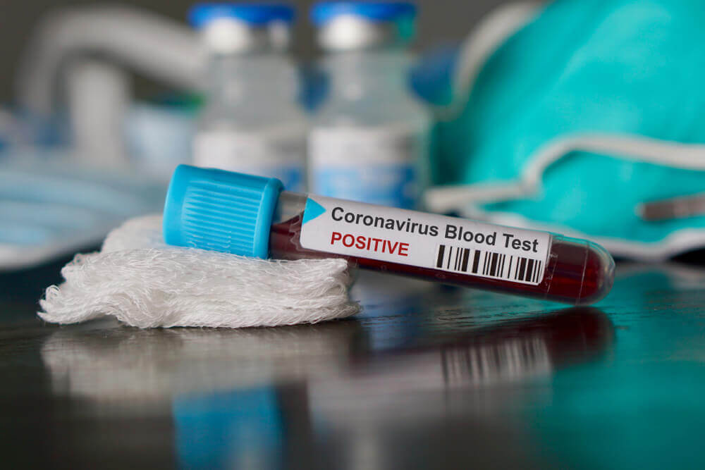 Positive blood test result for the new rapidly spreading Coronavirus,