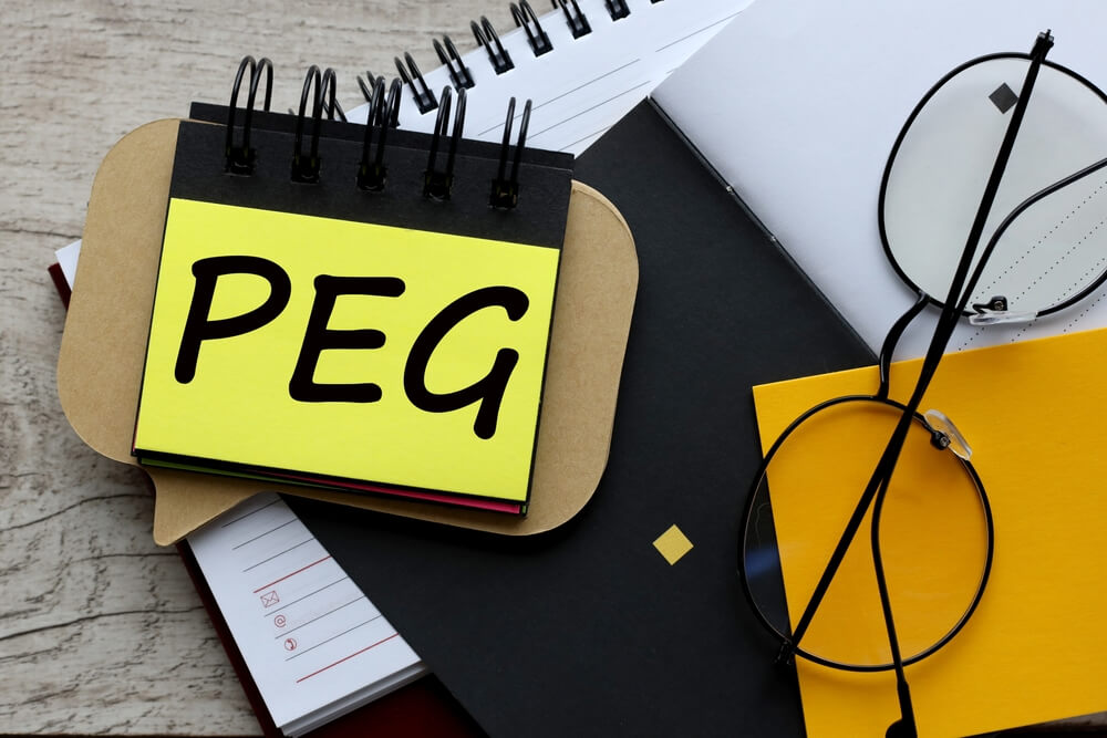 Understanding PEG adjustment  - Adjustable Peg Explained